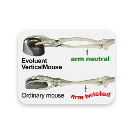 Ergonomic Evoluent 4 Vertical Mouse arm position diagram